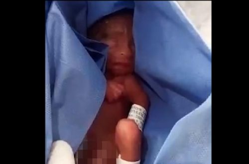 At Least 277 Babies Have Survived Botched Abortions
