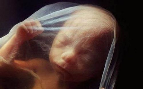 We Must Keep Fighting Abortion in 2025