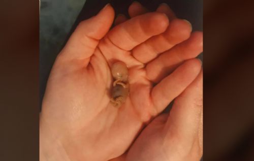 Woman Shocked When Delivering Dead Baby After Taking Abortion Pill: I Had No Idea This Would Happen