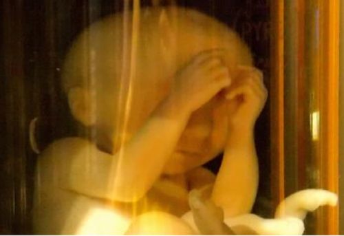 New Report Shows 1.1 Million Babies Killed in Abortions as Abortion Pills Flood America