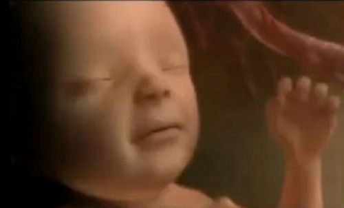 60 Percent of Babies Killed in Abortions are Killed With Abortion Pills