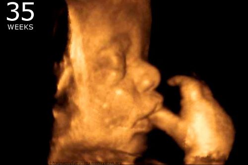 Pro-Life States Including Florida Fight Back Against Radical Abortion Amendments