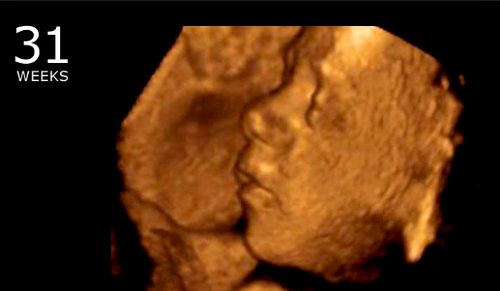 Trump Admin Ending $22 Million in Research With Aborted Baby Parts